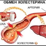 Высокий холестерин: что делать, и нужны ли таблетки?