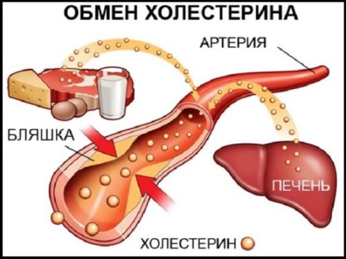 Высокий холестерин что делать, и нужны ли таблетки?