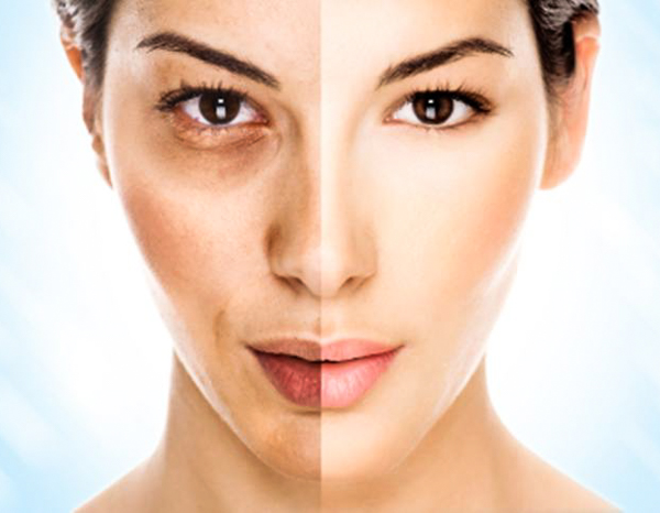 Пилинг, эксфолиация, очищение кожи, пилинг: до и после